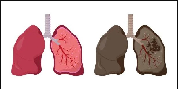 Expert Bronchoscopy Services in Jaipur, Rajasthan for Accurate Lung Diagnosis – Asthma Bhawan