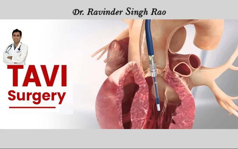 Advanced TAVI Surgery Specialist in Jaipur, Rajasthan – Dr. Ravinder Singh Rao