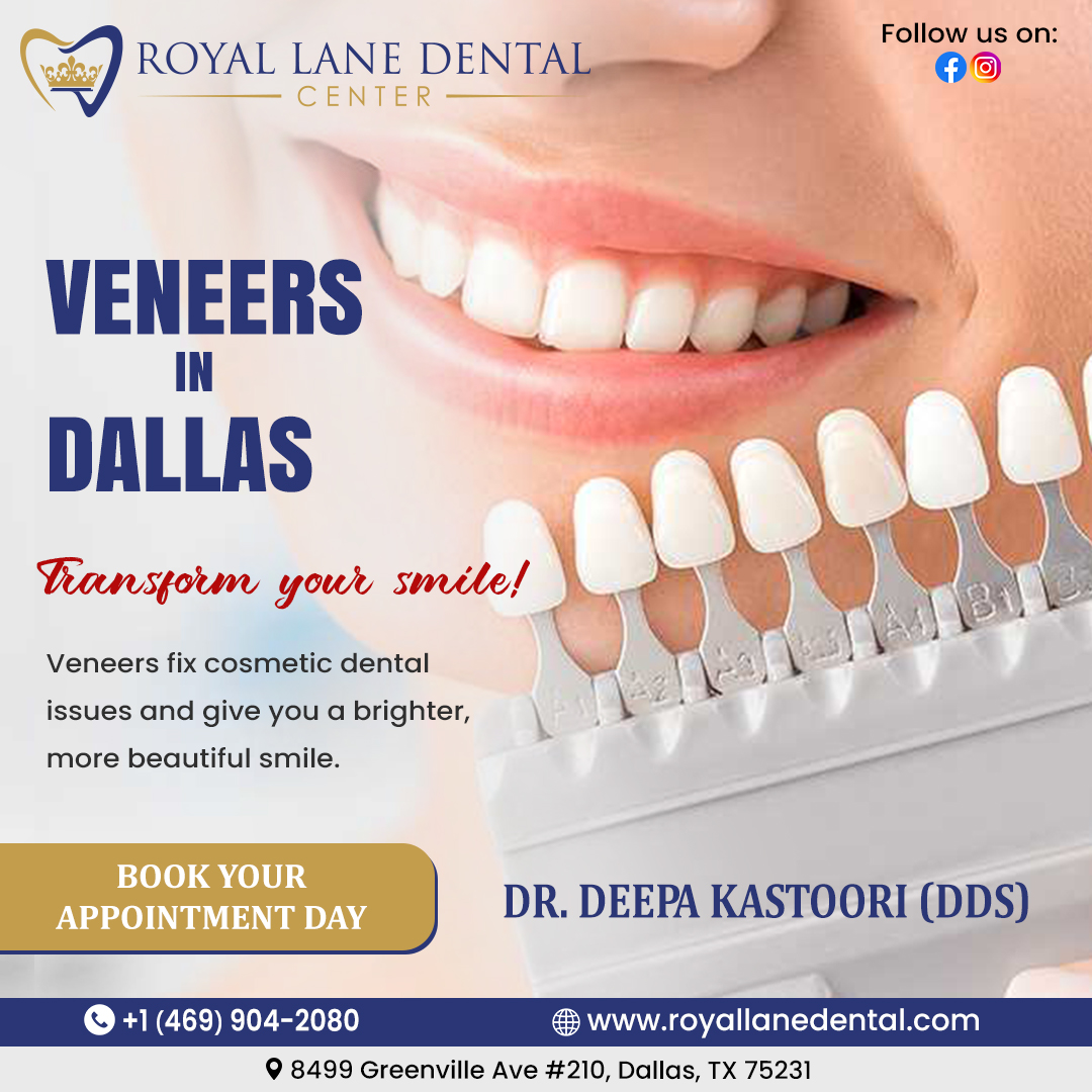 Veneers in Dallas