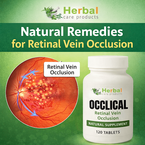 Alternative Remedies for Retinal Vein Occlusion without Injections